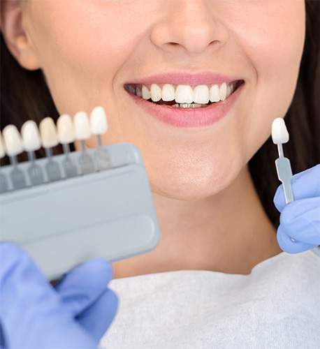 Why Not Just Invest in Composite Bonding from Santa Barbara Family Dentistry Image.