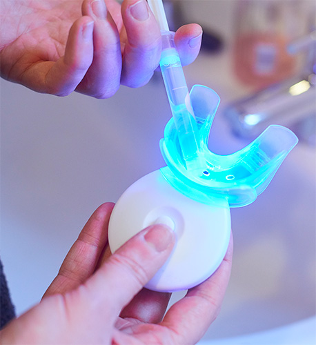 What Is At-Home Teeth Whitening in Santa Maria from Santa Barbara Family Dentistry Image.